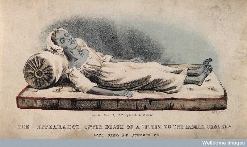 V0010484 A dead victim of cholera at Sunderland in 1832. Coloured lit